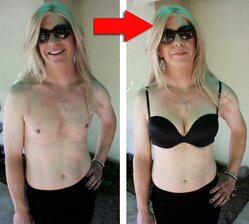 Комплект для создания груди с естественной ложбинкой